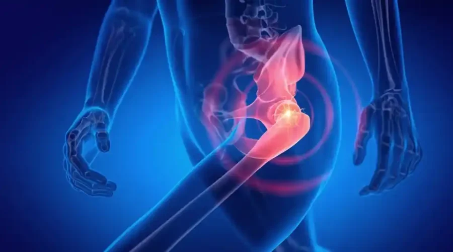 Total Hip Replacement in Nagpur