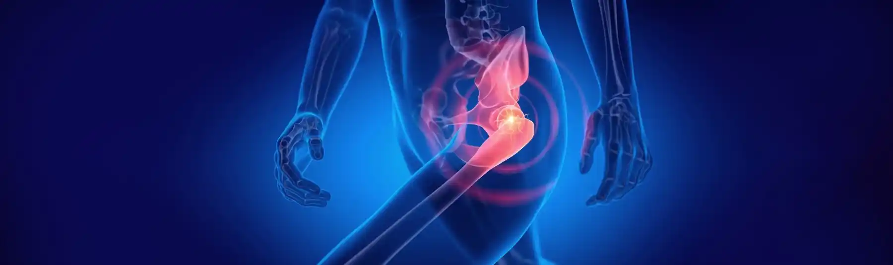 Total Hip Replacement in Nagpur