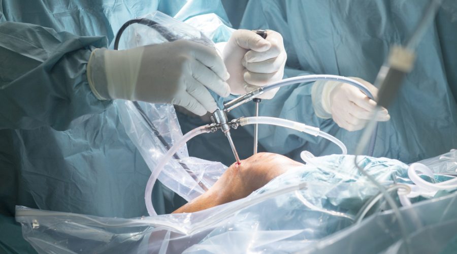 Knee orthoscopy treatment in Nagpur