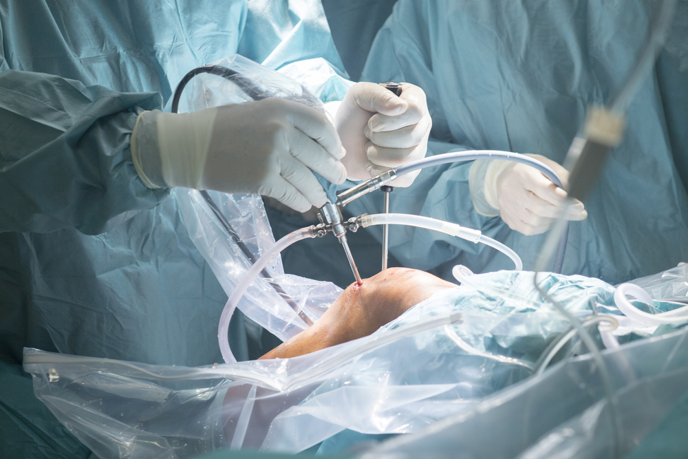 Knee orthoscopy treatment in Nagpur