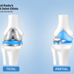 Total vs Partial Knee Replacement in Nagpur