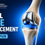Total Knee Replacement in Nagpur
