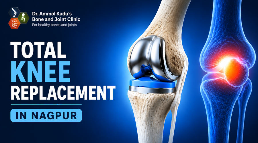 Total Knee Replacement in Nagpur